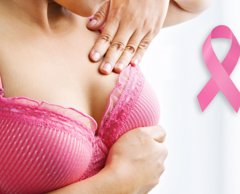 Рак молочной железы. 10 важных решений.
